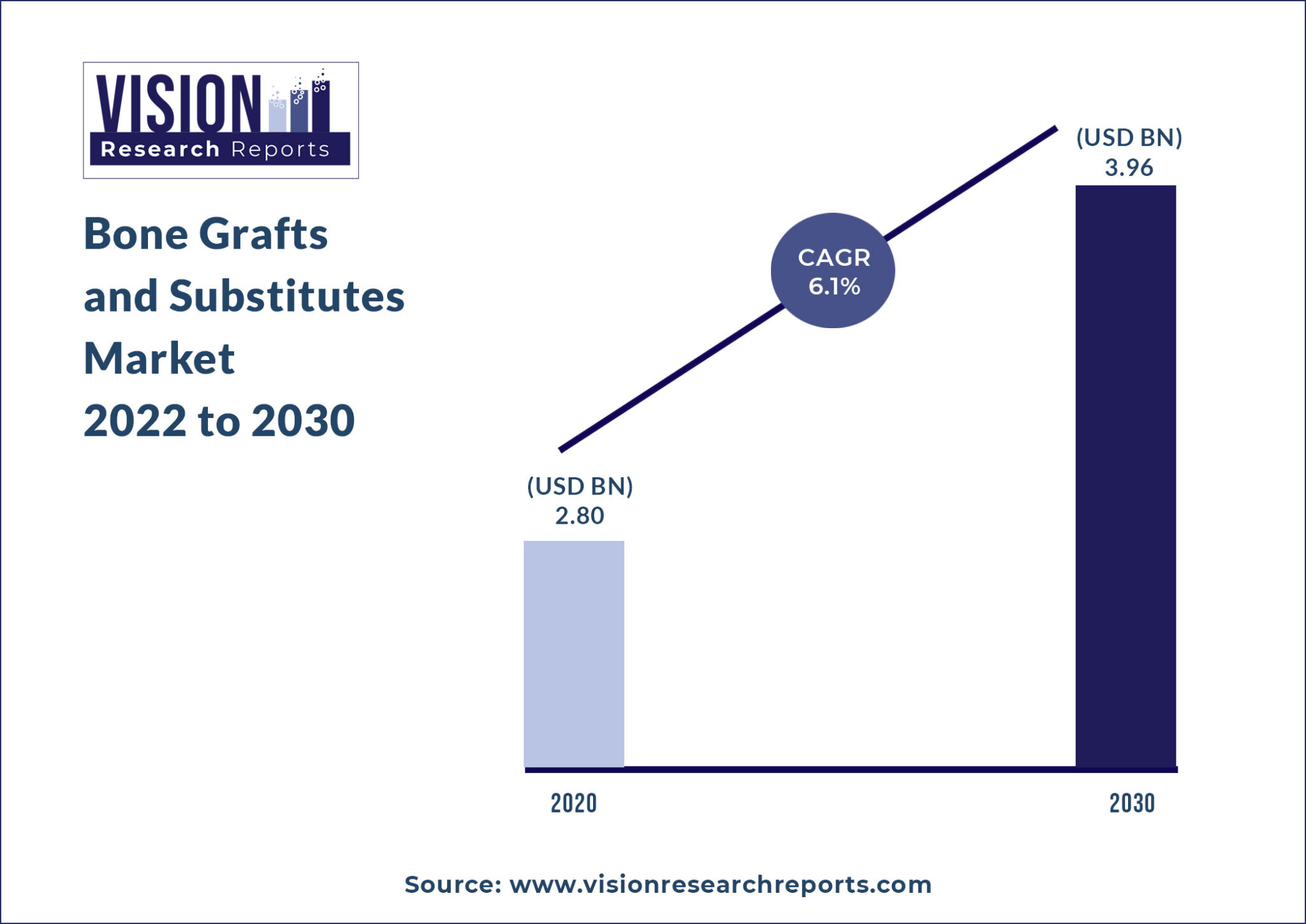 Bone Grafts And Substitutes Market Size Hit US 3 96 Billion By 2030